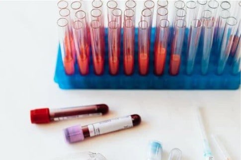 Know your heart health with a BNP Test