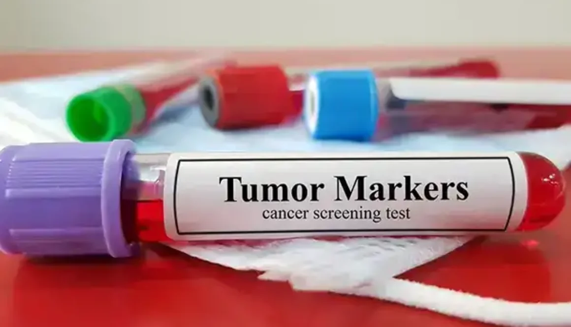 cancer marker testing