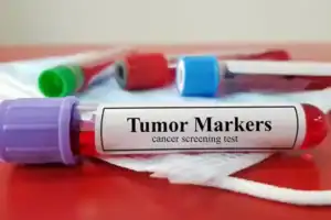 cancer marker testing