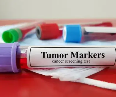 cancer marker testing